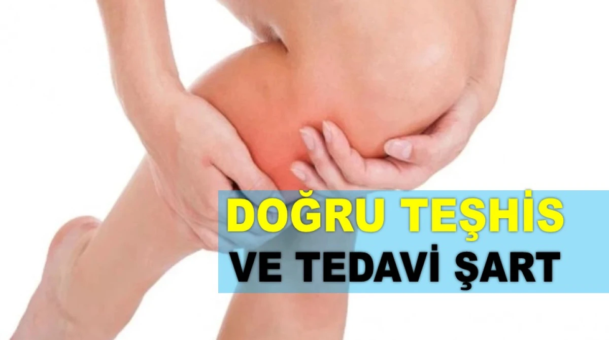 BACAK AĞRISI CİDDİ HASTALIKLARIN HABERCİSİ OLABİLİR