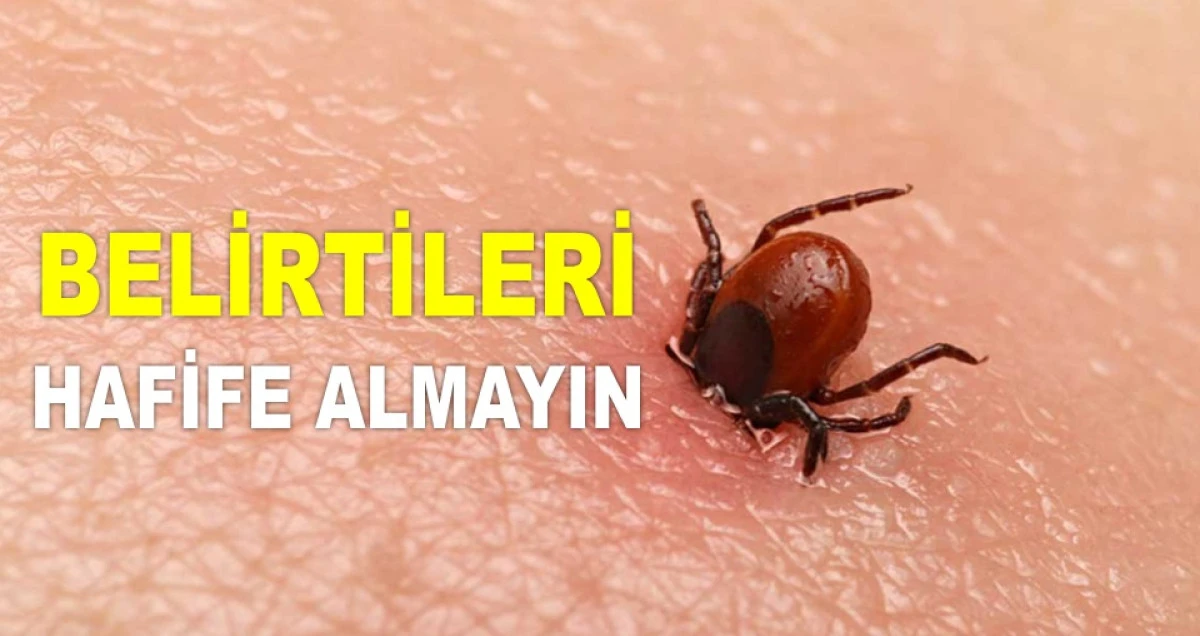 KENE ISIRMALARINA KRİTİK UYARI!